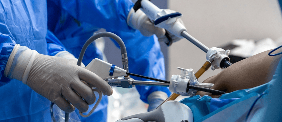 Laparoscopic Surgery