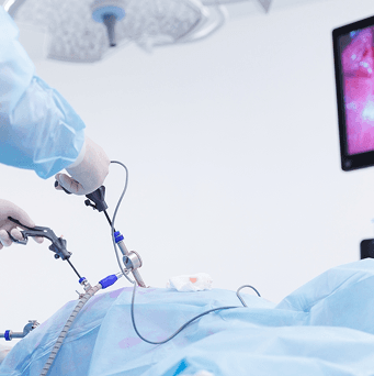 Laparoscopic Surgery
