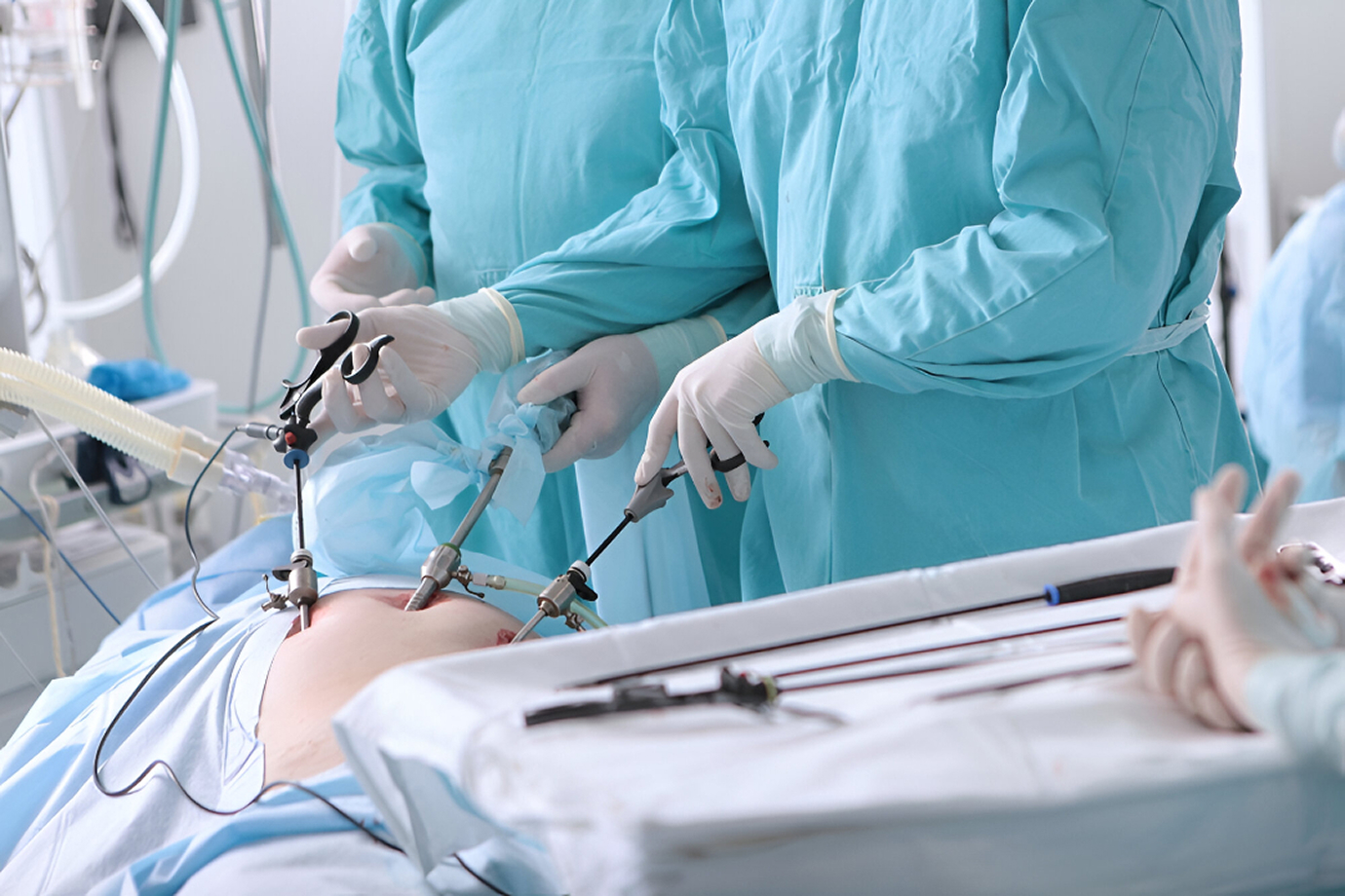Laparoscopic Surgery: Benefits, Recovery, and Why It's a Preferred Choice Today